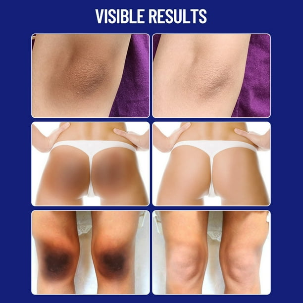 Crema Removedora de Manchas Oscuras - Banana Flavour